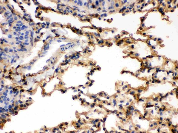 Figure 3. IHC analysis of S100A6 using anti-S100A6 antibody (PB9676). S100A6 was detected in paraffin-embedded section of Rat Lung tissues. Heat mediated antigen retrieval was performed in citrate buffer (pH6, epitope retrieval solution) for 20 mins. The tissue section was blocked with 10% goat serum. The tissue section was then incubated with 1microg/ml rabbit anti-S100A6 Antibody (PB9676) overnight at 4°C. Biotinylated goat anti-rabbit IgG was used as secondary antibody and incubated for 30 minutes at 37°C. The tissue section was developed using Strepavidin-Biotin-Complex (SABC)(Catalog # SA1022) with DAB as the chromogen.