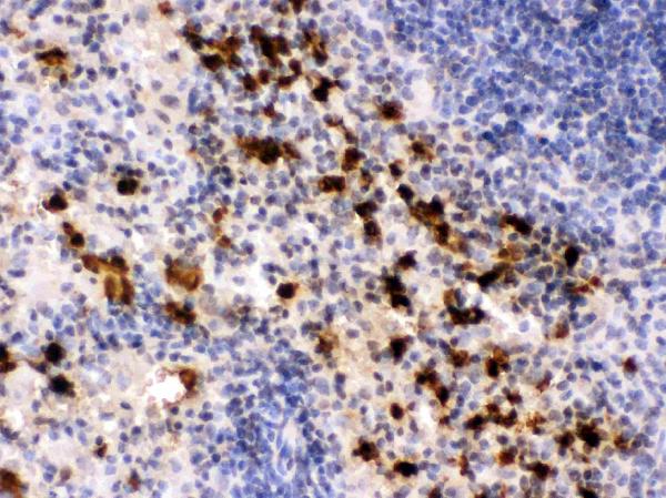 Figure 2. IHC analysis of S100A9 using anti-S100A9 antibody (PB9678). S100A9 was detected in a paraffin-embedded section of mouse spleen tissue. Heat mediated antigen retrieval was performed in EDTA buffer (pH 8.0, epitope retrieval solution). The tissue section was blocked with 10% goat serum. The tissue section was then incubated with 1 microg/ml rabbit anti-S100A9 Antibody (PB9678) overnight at 4°C. Biotinylated goat anti-rabbit IgG was used as secondary antibody and incubated for 30 minutes at 37°C. The tissue section was developed using Strepavidin-Biotin-Complex (SABC) (Catalog # SA1022) with DAB as the chromogen. Figure 2. IHC analysis of S100A9 using anti-S100A9 antibody (PB9678). S100A9 was detected in a paraffin-embedded section of mouse spleen tissue. Heat mediated antigen retrieval was performed in EDTA buffer (pH 8.0, epitope retrieval solution). The tissue section was blocked with 10% goat serum. The tissue section was then incubated with 1 microg/ml rabbit anti-S100A9 Antibody (PB9678) overnight at 4°C. Biotinylated goat anti-rabbit IgG was used as secondary antibody and incubated for 30 minutes at 37°C. The tissue section was developed using Strepavidin-Biotin-Complex (SABC) (Catalog # SA1022) with DAB as the chromogen.