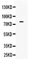  Western blot analysis of GRK using anti-GRK antibody (PB9682)