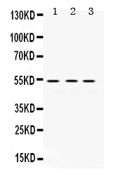 pb9725 1 WB anti mmp 1 antibody