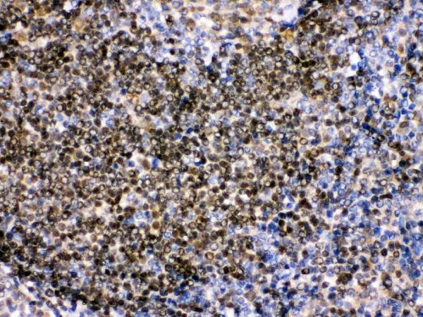 Figure 4. IHC analysis of Pax2 using anti-Pax2 antibody (PB9734). Pax2 was detected in a paraffin-embedded section of human tonsil tissue. Heat mediated antigen retrieval was performed in EDTA buffer (pH 8.0, epitope retrieval solution). The tissue section was blocked with 10% goat serum. The tissue section was then incubated with 1 microg/ml rabbit anti-Pax2 Antibody (PB9734) overnight at 4°C. Biotinylated goat anti-rabbit IgG was used as secondary antibody and incubated for 30 minutes at 37°C. The tissue section was developed using Strepavidin-Biotin-Complex (SABC) (Catalog # SA1022) with DAB as the chromogen. Figure 4. IHC analysis of Pax2 using anti-Pax2 antibody (PB9734). Pax2 was detected in a paraffin-embedded section of human tonsil tissue. Heat mediated antigen retrieval was performed in EDTA buffer (pH 8.0, epitope retrieval solution). The tissue section was blocked with 10% goat serum. The tissue section was then incubated with 1 microg/ml rabbit anti-Pax2 Antibody (PB9734) overnight at 4°C. Biotinylated goat anti-rabbit IgG was used as secondary antibody and incubated for 30 minutes at 37°C. The tissue section was developed using Strepavidin-Biotin-Complex (SABC) (Catalog # SA1022) with DAB as the chromogen.