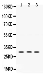 Figure 1. Western blot analysis of AMPK beta 2 using anti-AMPK beta 2 antibody (PB9739). Electrophoresis was performed on a 5-20% SDS-PAGE gel at 70V (Stacking gel) / 90V (Resolving gel) for 2-3 hours. Lane 1: Rat Brain Tissue Lysate at 50ug, Lane 2: Rat Skeletal Muscle Tissue Lysate at 50ug, Lane 3: PANC Whole Cell Lysate at 40ug. After electrophoresis, proteins were transferred to a nitrocellulose membrane at 150 mA for 50-90 minutes. Blocked the membrane with 5% non-fat milk/TBS for 1.5 hour at RT. The membrane was incubated with rabbit anti-AMPK beta 2 antigen affinity purified polyclonal antibody (Catalog # PB9739) at 0.5 microg/mL overnight at 4°C, then washed with TBS-0.1%Tween 3 times with 5 minutes each and probed with a goat anti-rabbit IgG-HRP secondary antibody at a dilution of 1:5000 for 1.5 hour at RT. The signal is developed using an Enhanced Chemiluminescent detection (ECL) kit (Catalog # EK1002) with Tanon 5200 system. A specific band was detected for AMPK beta 2 at approximately 30 kDa. The expected band size for AMPK beta 2 is at 30 kDa.