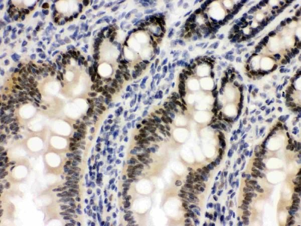 Figure 3. IHC analysis of OGT using anti-OGT antibody (PB9767). OGT was detected in a paraffin-embedded section of rat intestine tissue. Heat mediated antigen retrieval was performed in EDTA buffer (pH 8.0, epitope retrieval solution). The tissue section was blocked with 10% goat serum. The tissue section was then incubated with 1 microg/ml rabbit anti-OGT Antibody (PB9767) overnight at 4°C. Biotinylated goat anti-rabbit IgG was used as secondary antibody and incubated for 30 minutes at 37°C. The tissue section was developed using Strepavidin-Biotin-Complex (SABC) (Catalog # SA1022) with DAB as the chromogen. Figure 3. IHC analysis of OGT using anti-OGT antibody (PB9767). OGT was detected in a paraffin-embedded section of rat intestine tissue. Heat mediated antigen retrieval was performed in EDTA buffer (pH 8.0, epitope retrieval solution). The tissue section was blocked with 10% goat serum. The tissue section was then incubated with 1 microg/ml rabbit anti-OGT Antibody (PB9767) overnight at 4°C. Biotinylated goat anti-rabbit IgG was used as secondary antibody and incubated for 30 minutes at 37°C. The tissue section was developed using Strepavidin-Biotin-Complex (SABC) (Catalog # SA1022) with DAB as the chromogen.