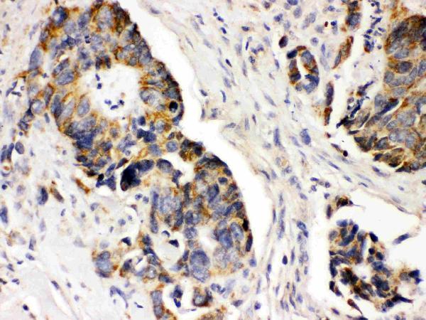 pb9771 2 IHC anti pdgfra pdgf receptor alpha picoband antibody