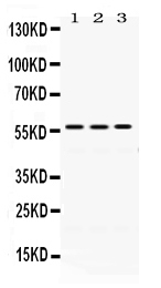 Figure 1. Western blot analysis of ERp57 using anti-ERp57 antibody (PB9772). Electrophoresis was performed on a 5-20% SDS-PAGE gel at 70V (Stacking gel) / 90V (Resolving gel) for 2-3 hours. The sample well of each lane was loaded with 50ug of sample under reducing conditions. Lane 1: Rat Liver Tissue Lysate, Lane 2: Mouse Liver Tissue Lysate, Lane 3: A549 Whole Cell Lysate. After Electrophoresis, proteins were transferred to a Nitrocellulose membrane at 150mA for 50-90 minutes. Blocked the membrane with 5% Non-fat Milk/ TBS for 1.5 hour at RT. The membrane was incubated with rabbit anti-ERp57 antigen affinity purified polyclonal antibody (Catalog # PB9772) at 0.5 microg/mL overnight at 4°C, then washed with TBS-0.1%Tween 3 times with 5 minutes each and probed with a goat anti-rabbit IgG-HRP secondary antibody at a dilution of 1:10000 for 1.5 hour at RT. The signal is developed using an Enhanced Chemiluminescent detection (ECL) kit (Catalog # EK1002) with Tanon 5200 system. A specific band was detected for ERp57 at approximately 57KD. The expected band size for ERp57 is at 57KD.