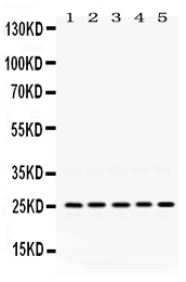 Western blot analysis of PGRMC1 using anti-PGRMC1 antibody (PB9775).