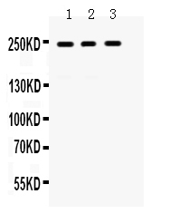 Figure 1. Western blot analysis of LAR using anti-LAR antibody (PB9786). Electrophoresis was performed on a 5-20% SDS-PAGE gel at 70V (Stacking gel) / 90V (Resolving gel) for 2-3 hours. The sample well of each lane was loaded with 40 ug of sample under reducing conditions. Lane 1: HELA Whole Cell Lysate, Lane 2: A431 Whole Cell Lysate, Lane 3: A549 Whole Cell Lysate. After electrophoresis, proteins were transferred to a nitrocellulose membrane at 150 mA for 50-90 minutes. Blocked the membrane with 5% non-fat milk/TBS for 1.5 hour at RT. The membrane was incubated with rabbit anti-LAR antigen affinity purified polyclonal antibody (Catalog # PB9786) at 0.5 microg/mL overnight at 4°C, then washed with TBS-0.1%Tween 3 times with 5 minutes each and probed with a goat anti-rabbit IgG-HRP secondary antibody at a dilution of 1:5000 for 1.5 hour at RT. The signal is developed using an Enhanced Chemiluminescent detection (ECL) kit (Catalog # EK1002) with Tanon 5200 system. A specific band was detected for LAR at approximately 240 kDa. The expected band size for LAR is at 240 kDa.
