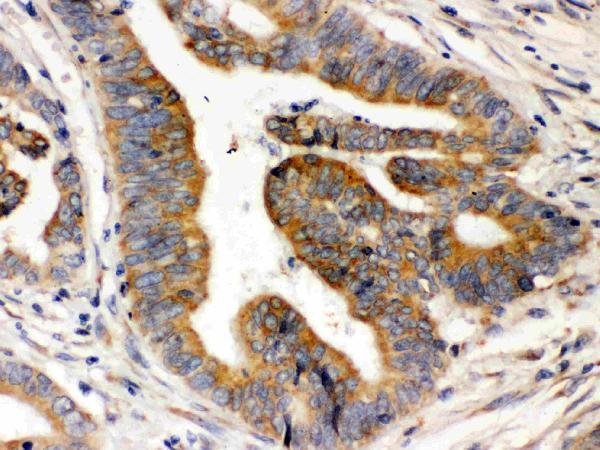  IHC analysis of Rab5 using anti-Rab5 antibody (PB9787)