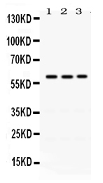 Western blot analysis of RAG2 using anti-RAG2 antibody (PB9793).