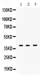 Western blot analysis of POLB using anti-POLB antibody (PB9812).
