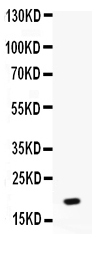  Western blot analysis of NAP2 using anti-NAP2 antibody (PB9878)