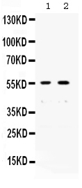  Western blot analysis of XRCC4 using anti-XRCC4 antibody (PB9908)