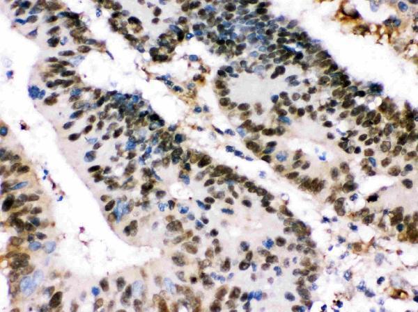  IHC analysis of XRCC4 using anti-XRCC4 antibody (PB9908)