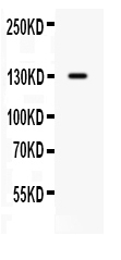  Western blot analysis of CDCP1 using anti-CDCP1 antibody (PB9933)