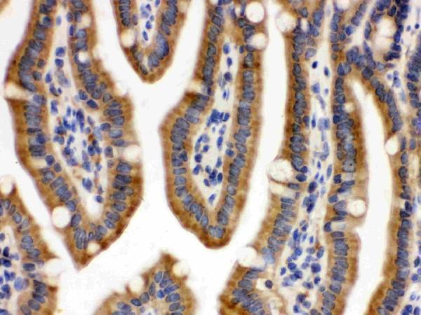  IHC analysis of CDCP1 using anti-CDCP1 antibody (PB9933)