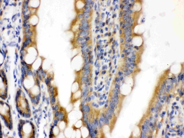 pb9933 3 IHC anti cdcp1 picoband antibody