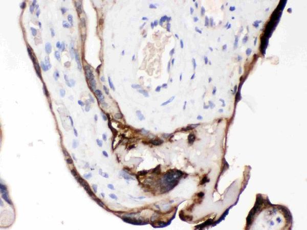 pb9933 4 IHC anti cdcp1 picoband antibody