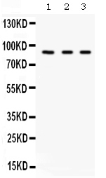 Figure 1. Western blot analysis of Factor B using anti-Factor B antibody (PB9934). Electrophoresis was performed on a 5-20% SDS-PAGE gel at 70V (Stacking gel) / 90V (Resolving gel) for 2-3 hours. The sample well of each lane was loaded with 30 ug of sample under reducing conditions. Lane 1: A549 whole cell lysates, Lane 2: 293T whole cell lysates, Lane 3: HELA whole cell lysates. After electrophoresis, proteins were transferred to a nitrocellulose membrane at 150 mA for 50-90 minutes. Blocked the membrane with 5% non-fat milk/TBS for 1.5 hour at RT. The membrane was incubated with rabbit anti-Factor B antigen affinity purified polyclonal antibody (Catalog # PB9934) at 0.5 microg/mL overnight at 4°C, then washed with TBS-0.1%Tween 3 times with 5 minutes each and probed with a goat anti-rabbit IgG-HRP secondary antibody at a dilution of 1:5000 for 1.5 hour at RT. The signal is developed using an Enhanced Chemiluminescent detection (ECL) kit (Catalog # EK1002) with Tanon 5200 system. A specific band was detected for Factor B at approximately 86 kDa. The expected band size for Factor B is at 86 kDa.