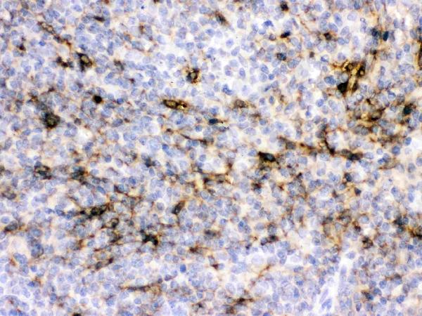 Figure 3. IHC analysis of CRYAA using anti-CRYAA antibody (PB9940). CRYAA was detected in paraffin-embedded section of rat spleen tissues. Heat mediated antigen retrieval was performed in citrate buffer (pH6, epitope retrieval solution) for 20 mins. The tissue section was blocked with 10% goat serum. The tissue section was then incubated with 1microg/ml rabbit anti-CRYAA Antibody (PB9940) overnight at 4°C. Biotinylated goat anti-rabbit IgG was used as secondary antibody and incubated for 30 minutes at 37°C. The tissue section was developed using Strepavidin-Biotin-Complex (SABC)(Catalog # SA1022) with DAB as the chromogen.