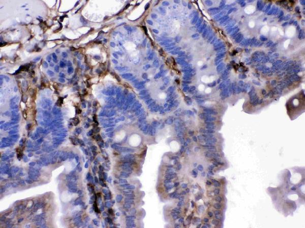 pb9944 2_1 IHC anti fgf1 fgf acidic picoband antibody