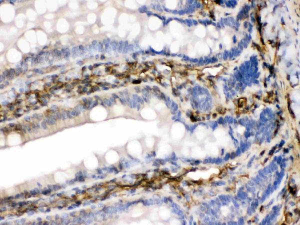 pb9944 3_1 IHC anti fgf1 fgf acidic picoband antibody