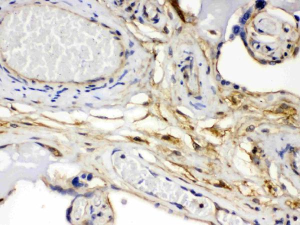 pb9944 4_1 IHC anti fgf1 fgf acidic picoband antibody