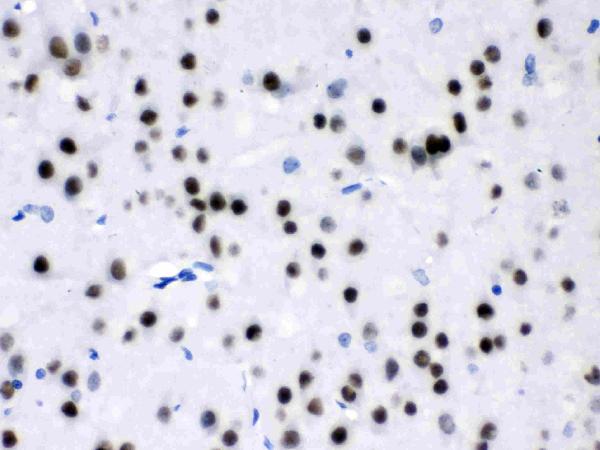 Figure 3. IHC analysis of MEF2A using anti-MEF2A antibody (PB9953). MEF2A was detected in a paraffin-embedded section of rat brain tissue. Heat mediated antigen retrieval was performed in EDTA buffer (pH 8.0, epitope retrieval solution). The tissue section was blocked with 10% goat serum. The tissue section was then incubated with 1 microg/ml rabbit anti-MEF2A Antibody (PB9953) overnight at 4°C. Biotinylated goat anti-rabbit IgG was used as secondary antibody and incubated for 30 minutes at 37°C. The tissue section was developed using Strepavidin-Biotin-Complex (SABC) (Catalog # SA1022) with DAB as the chromogen.
