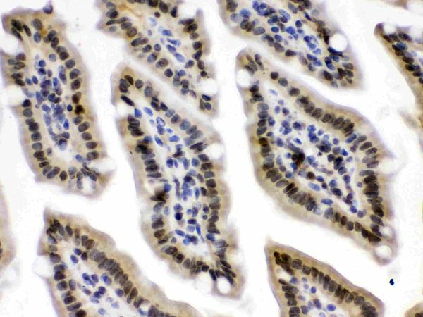 Figure 2. IHC analysis of CRM1 using anti-CRM1 antibody (PB9966). CRM1 was detected in paraffin-embedded section of mouse intestine tissues. Heat mediated antigen retrieval was performed in citrate buffer (pH6, epitope retrieval solution) for 20 mins. The tissue section was blocked with 10% goat serum. The tissue section was then incubated with 1microg/ml rabbit anti-CRM1 Antibody (PB9966) overnight at 4°C. Biotinylated goat anti-rabbit IgG was used as secondary antibody and incubated for 30 minutes at 37°C. The tissue section was developed using Strepavidin-Biotin-Complex (SABC)(Catalog # SA1022) with DAB as the chromogen.