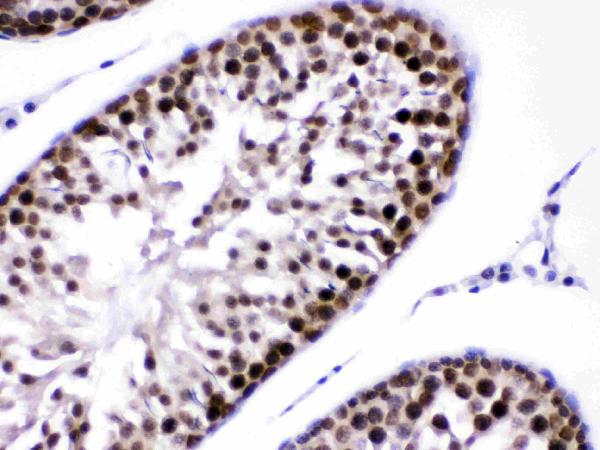 Figure 3. IHC analysis of CRM1 using anti-CRM1 antibody (PB9966). CRM1 was detected in paraffin-embedded section of rat testis tissues. Heat mediated antigen retrieval was performed in citrate buffer (pH6, epitope retrieval solution) for 20 mins. The tissue section was blocked with 10% goat serum. The tissue section was then incubated with 1microg/ml rabbit anti-CRM1 Antibody (PB9966) overnight at 4°C. Biotinylated goat anti-rabbit IgG was used as secondary antibody and incubated for 30 minutes at 37°C. The tissue section was developed using Strepavidin-Biotin-Complex (SABC)(Catalog # SA1022) with DAB as the chromogen.