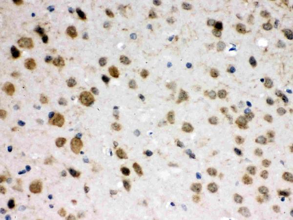 pb9972 2 IHC anti abr picoband antibody