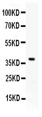 Figure 1. Western blot analysis of PD-L1 using anti-PD-L1 antibody (PB9994). Electrophoresis was performed on a 5-20% SDS-PAGE gel at 70V (Stacking gel) / 90V (Resolving gel) for 2-3 hours. The sample well of each lane was loaded with 30 ug of sample under reducing conditions. Lane 1: mouse brain tissue lysates. After electrophoresis, proteins were transferred to a nitrocellulose membrane at 150 mA for 50-90 minutes. Blocked the membrane with 5% non-fat milk/TBS for 1.5 hour at RT. The membrane was incubated with rabbit anti-PD-L1 antigen affinity purified polyclonal antibody (Catalog # PB9994) at 0.5 microg/mL overnight at 4°C, then washed with TBS-0.1%Tween 3 times with 5 minutes each and probed with a goat anti-rabbit IgG-HRP secondary antibody at a dilution of 1:5000 for 1.5 hour at RT. The signal is developed using an Enhanced Chemiluminescent detection (ECL) kit (Catalog # EK1002) with Tanon 5200 system. A specific band was detected for PD-L1 at approximately 39 kDa. The expected band size for PD-L1 is at 33 kDa.