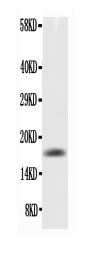 Western blot analysis of TNF alpha using anti-TNF alpha antibody (RP1000).