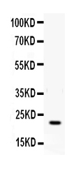 Western blot analysis of IFN gamma using anti-IFN gamma antibody (RP1001).