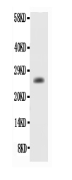 Western blot analysis of BCL-2 using anti-BCL-2 antibody (RP1003).