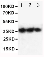 Anti-human EPO antibody, RP1004, Western blotting Lane 1: Recombinant human EPO Protein 10ng Lane 2: Recombinant human EPO Protein 5ng Lane 3: Recombinant human EPO Protein 2
