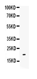 Western blot analysis of IL-10 using anti-IL-10 antibody (RP1014).