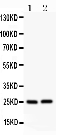 rp1042 1 WB anti claudin 2 antibody