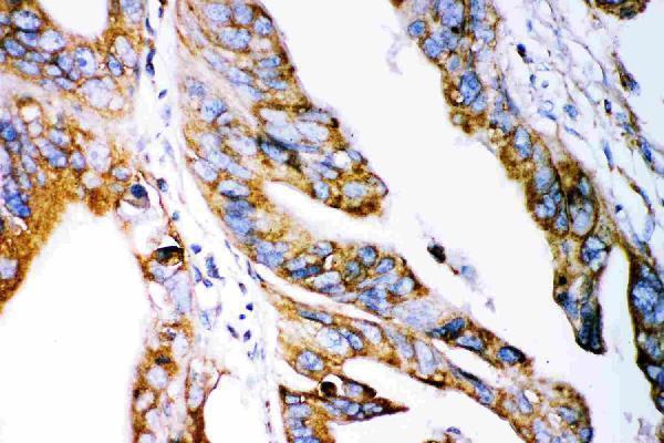 rp1042 2 IHC anti claudin 2 antibody