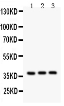 Anti-IL-3 antibody, RP1046, Western blottingAll lanes: Anti IL-3 (RP1046) at 0