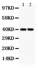 rp1067 1 WB anti sfrp4 antibody
