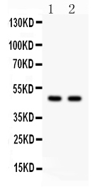 Anti-PTOV1 antibody, RP1087, Western blotting All lanes: Anti PTOV1 (RP1087) at 0.5ug/ml