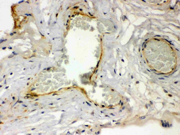 rp1092 2 IHC anti thrombin receptor antibody