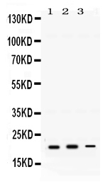 rp1099 1_3 WB anti gtpase hras antibody