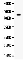 rp1102 1 WB anti smurf 2 antibody