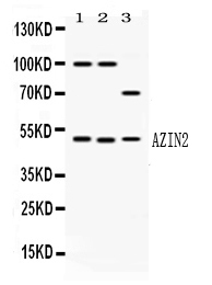 rp1112 1 WB anti azin2 odcp picoband antibody