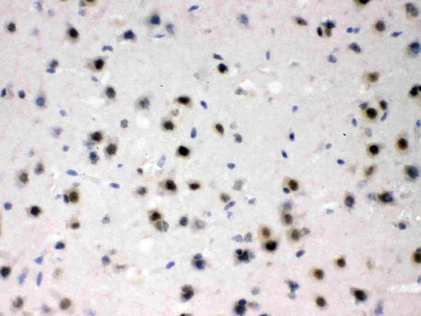 rp1112 2 IHC anti azin2 odcp picoband antibody