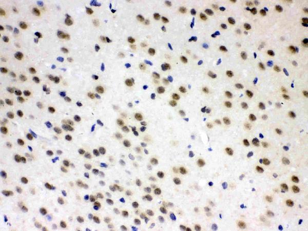 rp1112 3 IHC anti azin2 odcp picoband antibody