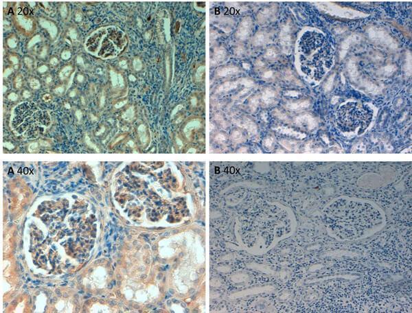 b00564 fn1 primary antibodies ihc testing 2