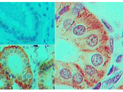 Immunohistochemistry of Mouse Anti-IL-17F antibody