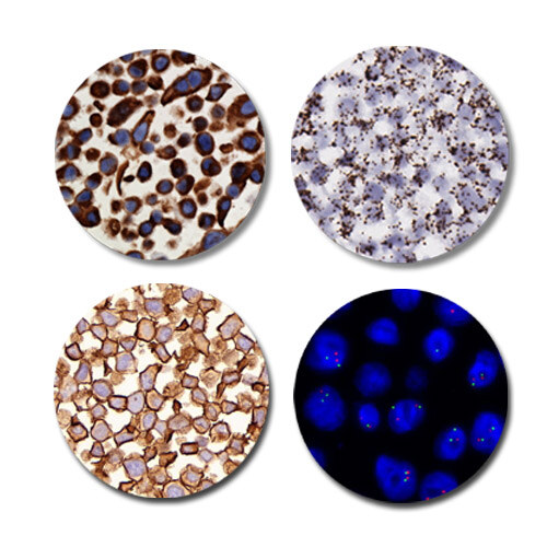 SKBR3 FFPE Cell Pellet